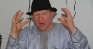 Présidentielle 2024: Les albinos craignent pour leur sécurité et alertent