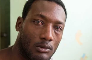 Epidémie de "CHIKUNGUNYA": 47 cas recensés dans la région de Kédougou