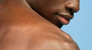 Coup de soleil : quelles sont les conséquences pour le corps humain ?