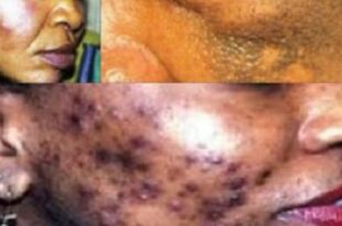 e17aa5a763b0a4e6e4c64af2b812472b225eb303