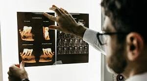 Le Scorbut: Cette maladie que l'on croyait disparue refait surface de manière inquiétante