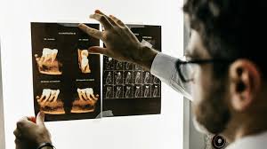 Le Scorbut: Cette maladie que l'on croyait disparue refait surface de manière inquiétante