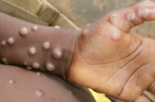 1366x768 cmsv2 8b869c69 ce73 589b 9f03 5e3ea4a39409 6709082