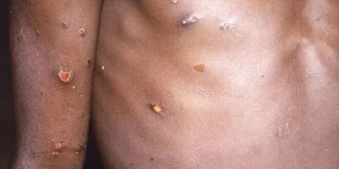 thumb 1260x800 68a9f741d5fb9 kzR4MrIdzk