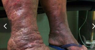 Screenshot 20260307 002124 1