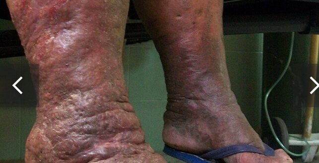 Screenshot 20260307 002124 1